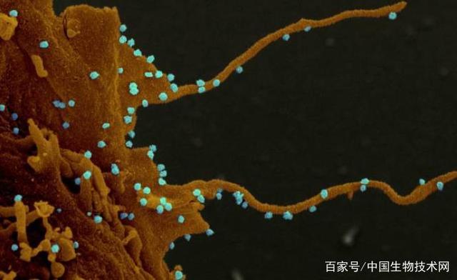 新冠病毒感染细胞显微图像首次公布，专家称传播方式“邪恶”