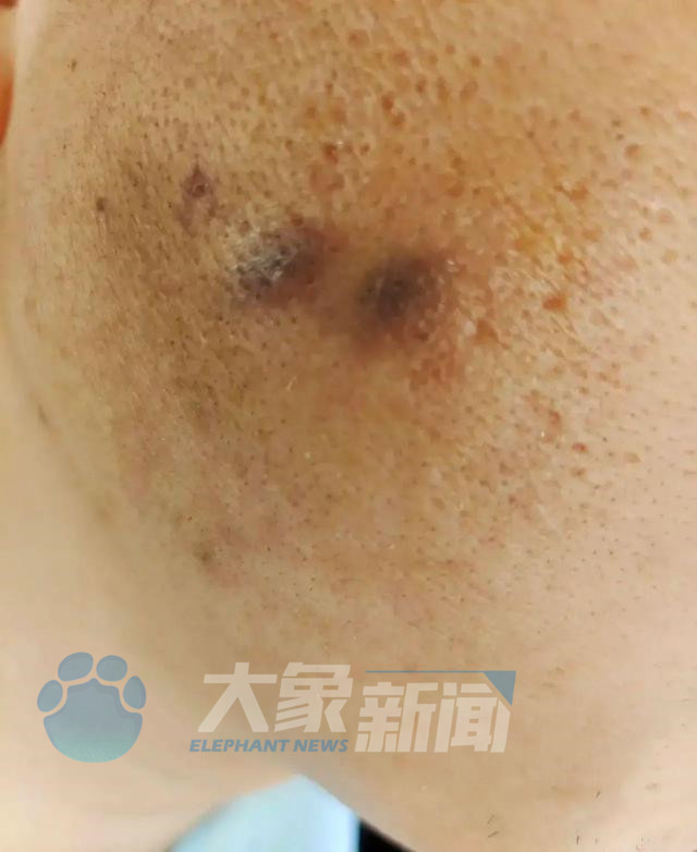 烟头烫员工高管被刑拘，当事人：副总嫌我把事反映到网上，我会离职