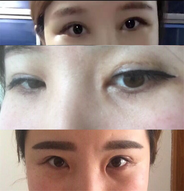 4女子整容致9级伤残，院长狂言：大不了不赔钱，重开一家也就花200万