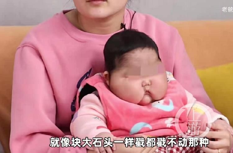 5个月大女婴抹了婴儿霜后变“大头娃娃”？福建漳州卫健委回应